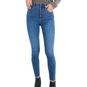Madewell High-Rise Skinny Jeans: Button-Front